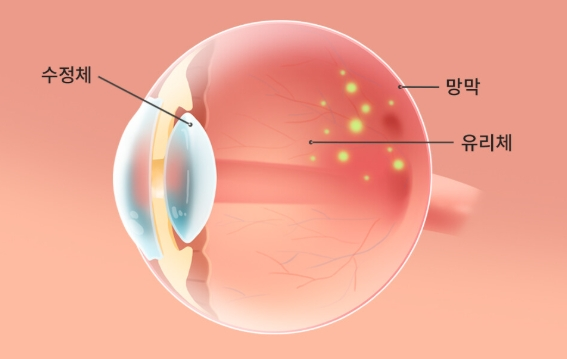 시니어 루테인 효과 5가지, 의사도 권하는 눈 영양제는?