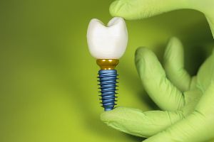 용인시-기흥구-임플란트-치과-가격-비용-싼-곳,저렴한-곳,잘하는-곳,유명한-곳-BEST20-추천16