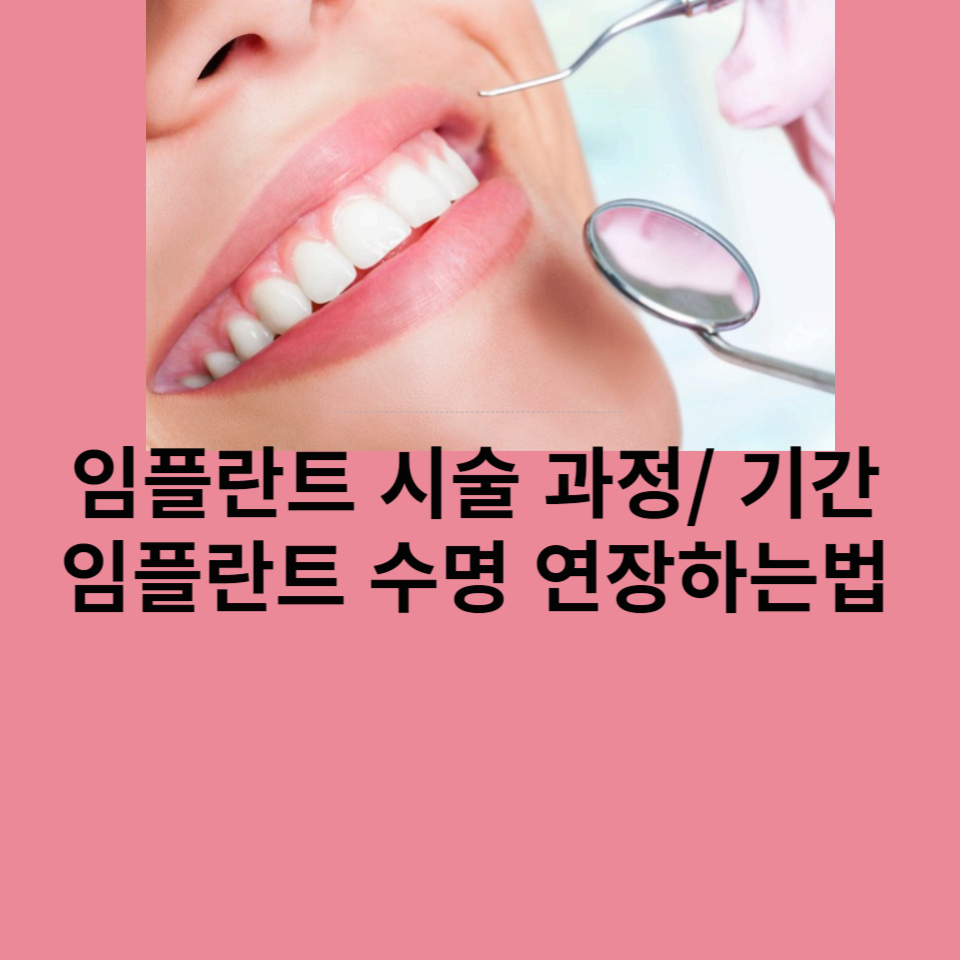 임플란트-과정-기간-수명