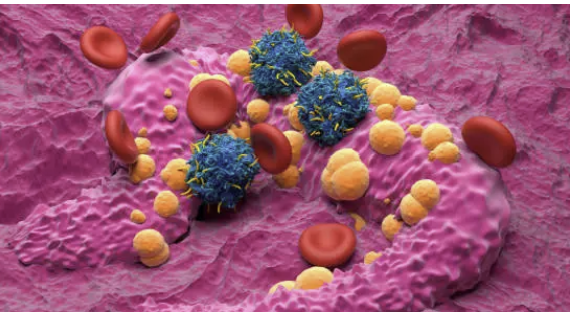 CAR-T 세포 치료의 대사체 기반 품질 평가(QC) 전략