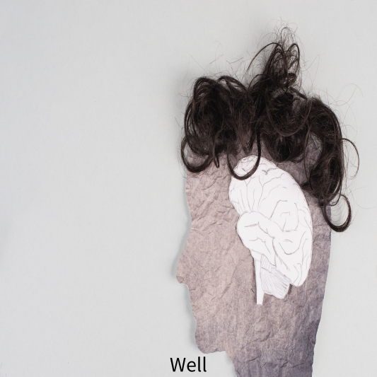 파킨슨병 초기증상