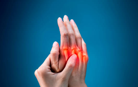 류마티스 관절염