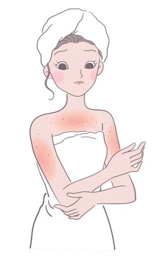 모낭염 원인과 치료방법