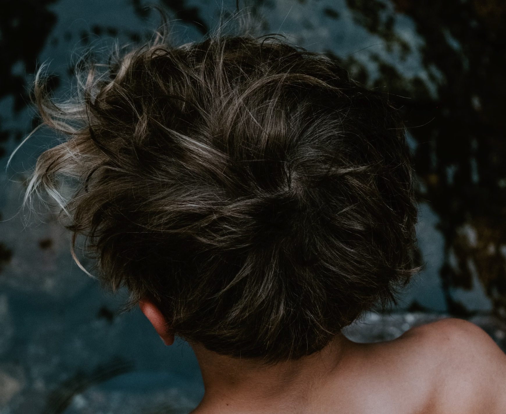 두피 모낭염 연고