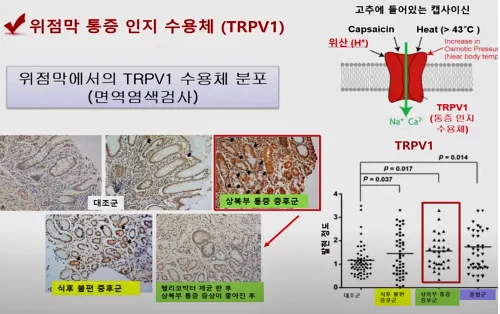 내장과민성을 설명하기 위한 위점막 통증 인지 수용체TRPV1