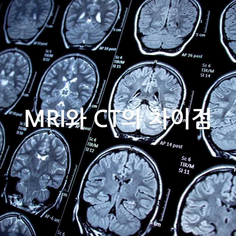 MRI와 CT의 차이점