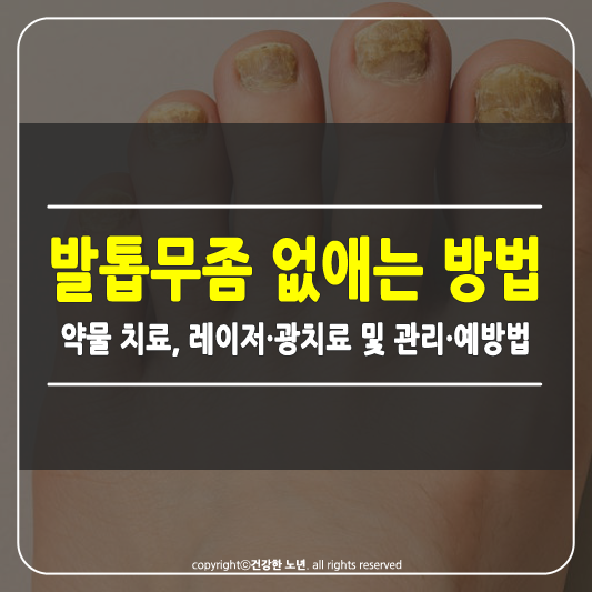 발톱무좀 없애는 방법 썸네일