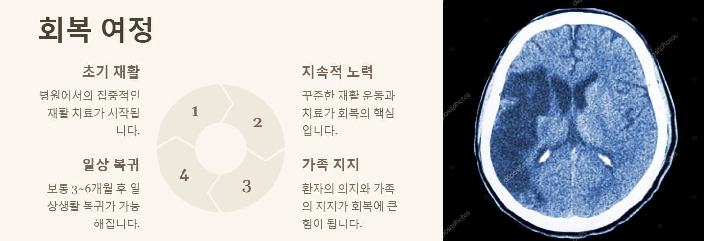뇌경색 초기증상 치료방법