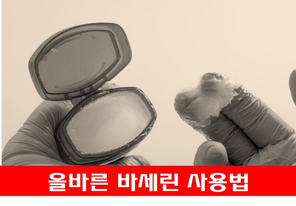 바세린 사진