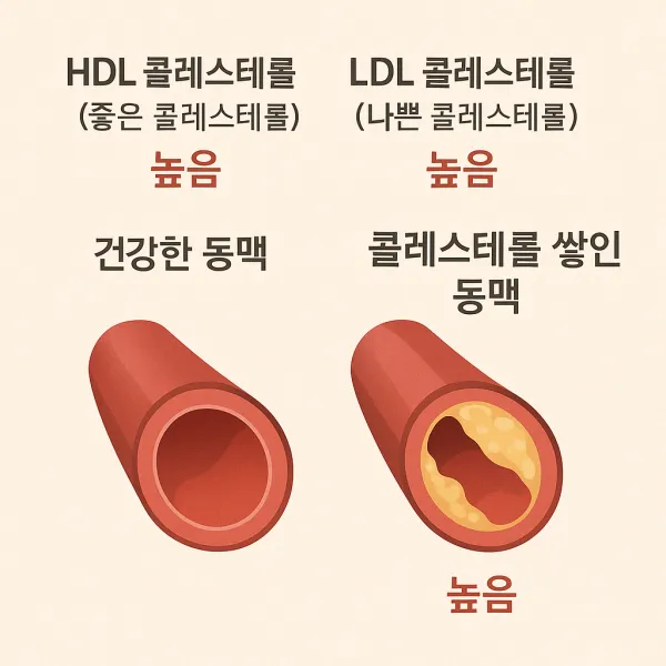 심혈관 위험