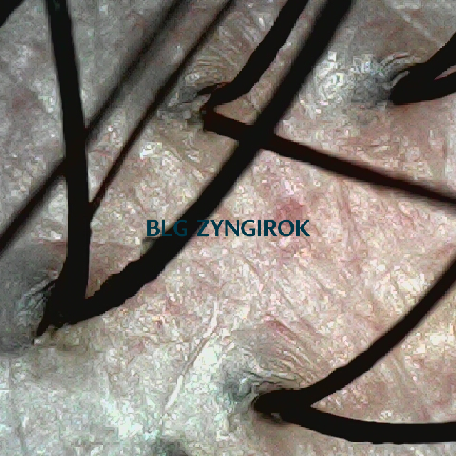 피나모아 복용 17주차 - 뒷머리 모습이다.