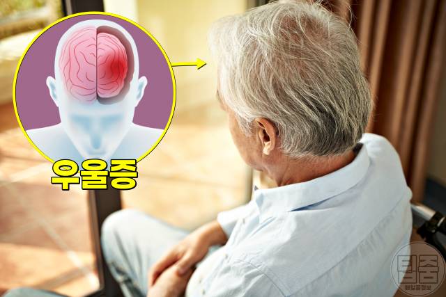 치매 증상 의심 뇌종양 갑상선 비타민 섬마 우울증
