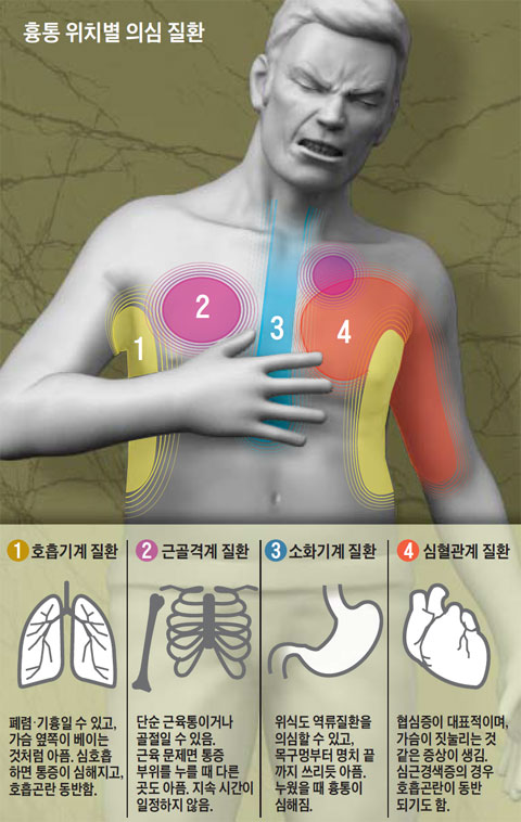 오른쪽 가슴이 뻐근한 증상 원인 7가지, 그냥 지나치면 안 됩니다