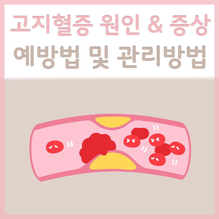 혈관에-쌓인-지방