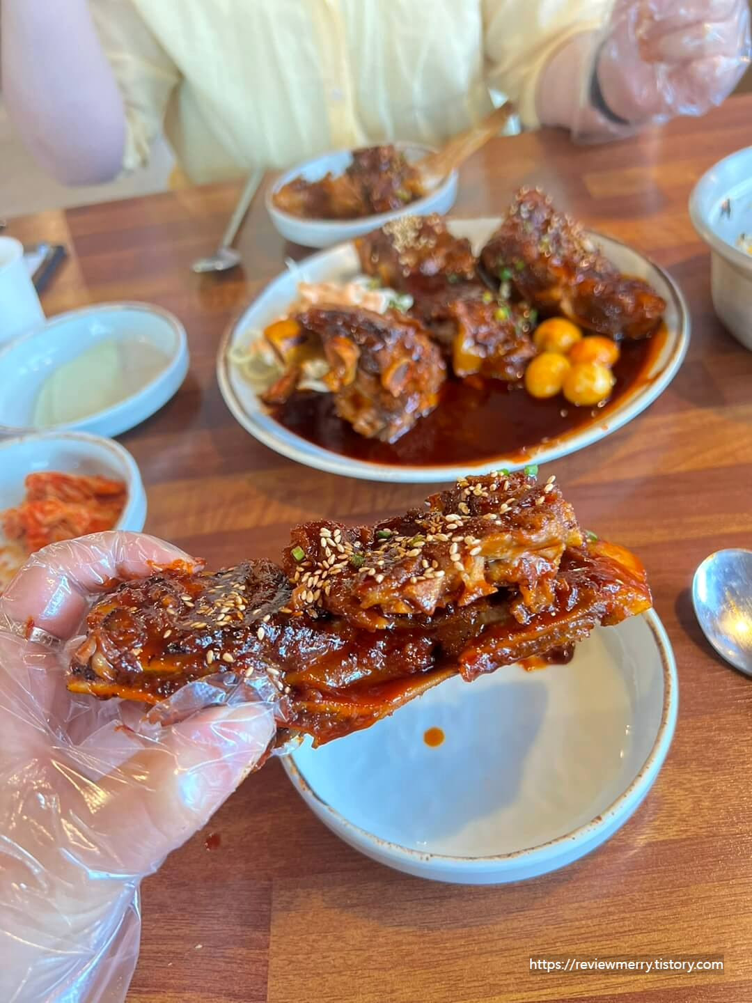 뼈 확대 사진