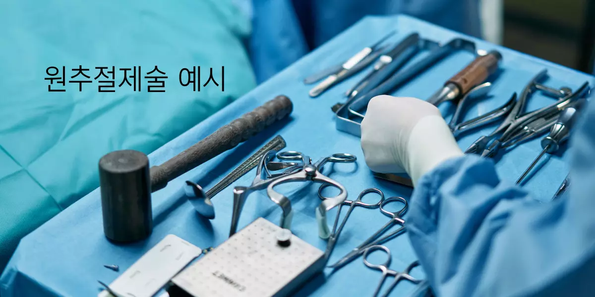 원추절제술 수술 도구 파란천 위에 올려진 가위, 망치 등 의료용 수술도구들