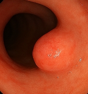 선종 뜻 선종과 용종의 차이