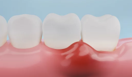 잇몸이 붓고 아픈 모습