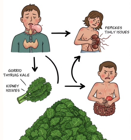 컬리케일 부작용