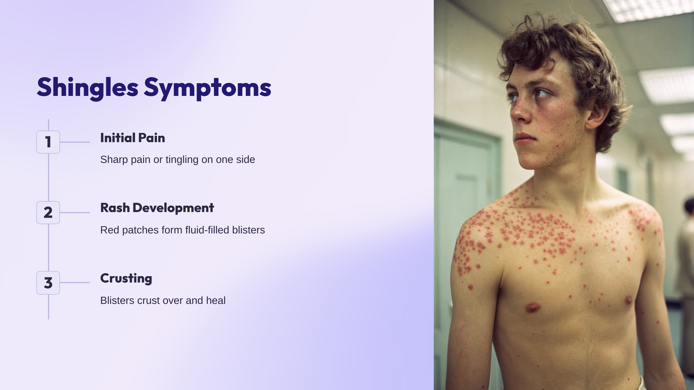 close-up of shingles rash showing red blisters in a band-like pattern on one side of torso, clinical lighting, detailed medical image