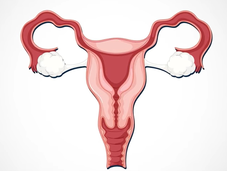 생리 냄새가 지독해요