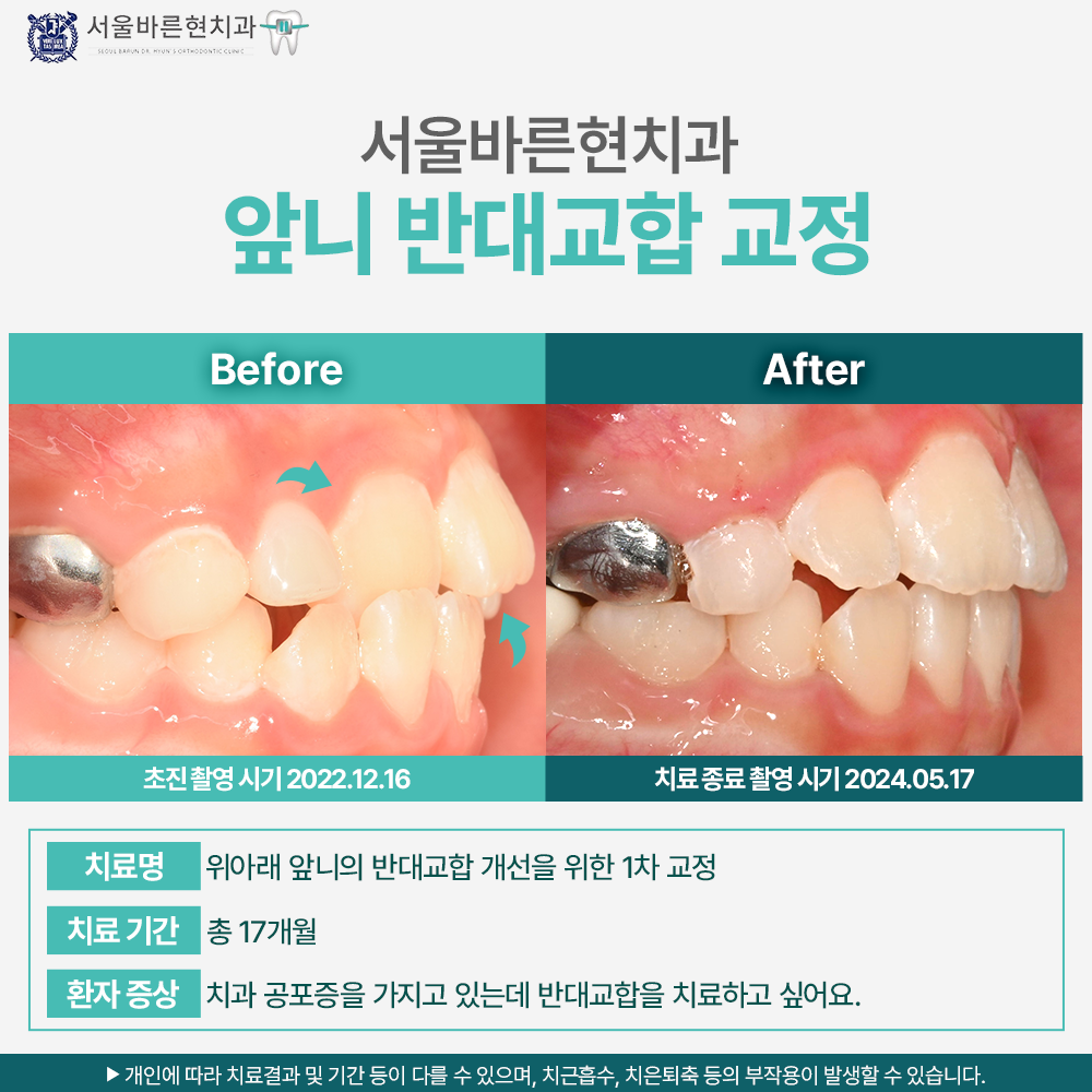 해운대교정치과