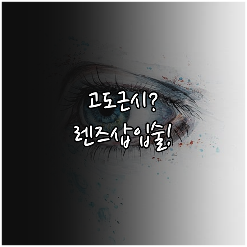 고도근시와 얇은 각막을 위한 시력교정..
