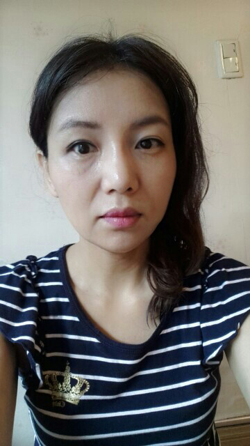 상안검 수술 후기