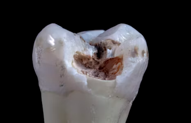 라이나생명 치아보험 청구서류 해지 보장내용