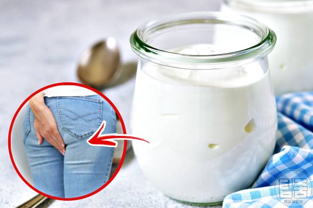 변비 자연치료 요거트