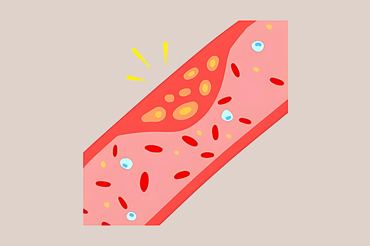 심혈관-건강-증진