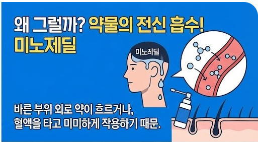 미녹시딜 부작용