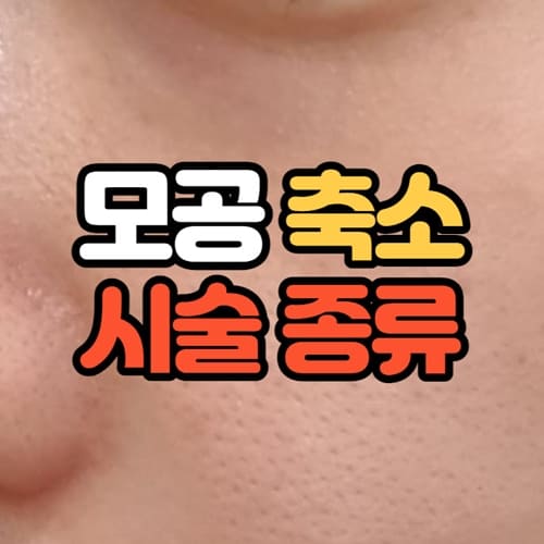 모공축소 시술