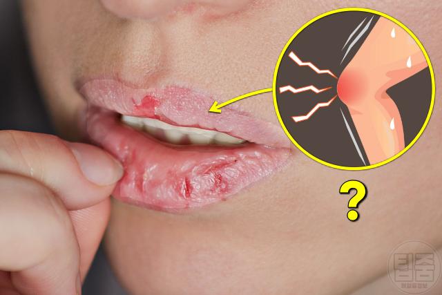 입이 마르는 이유, 입마름 병,팁줌