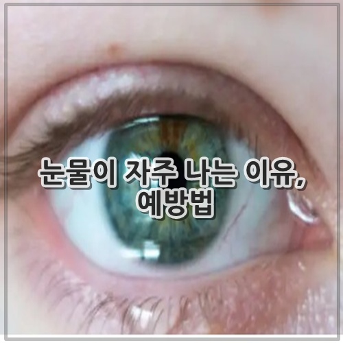 눈물이 자주 나는 이유, 예방법