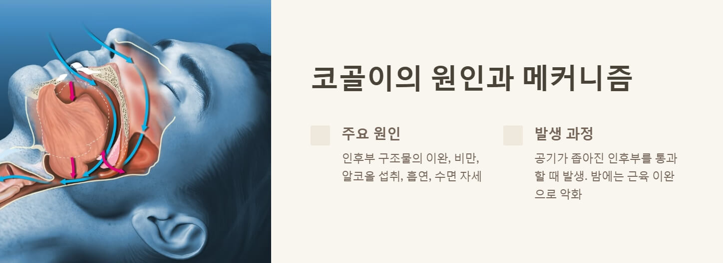 코골이 치료법