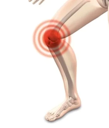 관절염 증상 원인 예방방법 좋은음식 - 1. 관절염이란? 관절염의 정의 관절염 증상 원인 예방방법 좋은음식 - 1. 관절염이란? 관절염의 정의