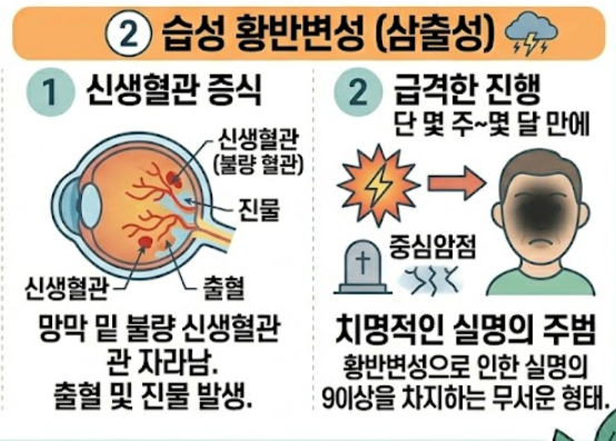황반변성 증상