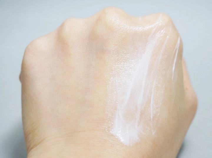 손끝-갈라짐-보습제