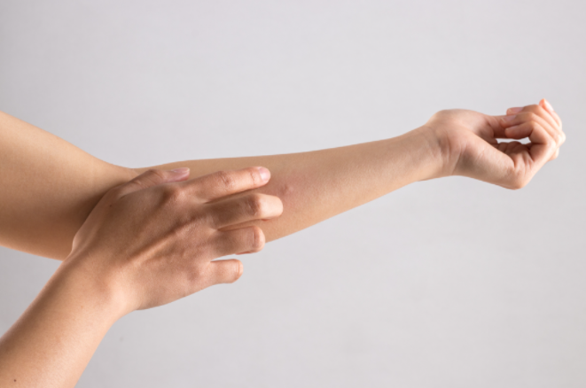 팔을 긁는 여성