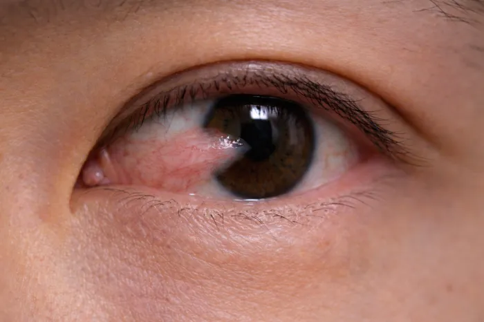 안과 질환의 종류와 증상