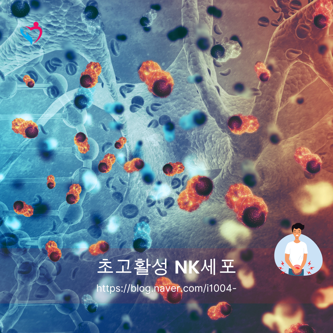 NK세포 암 예방 일본 치료에 대하여