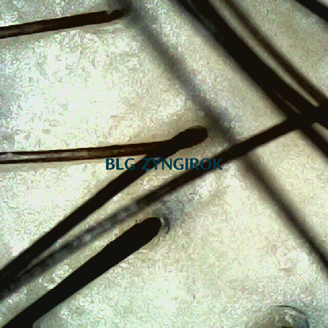 탈모 극복 프로젝트 - 정수리 두피 모습이다.