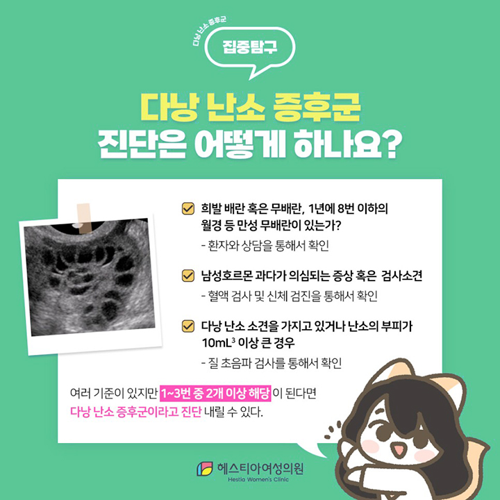 다낭 난소 증후군 진단