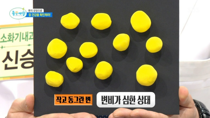 변비 증상 자가 진단 테스트