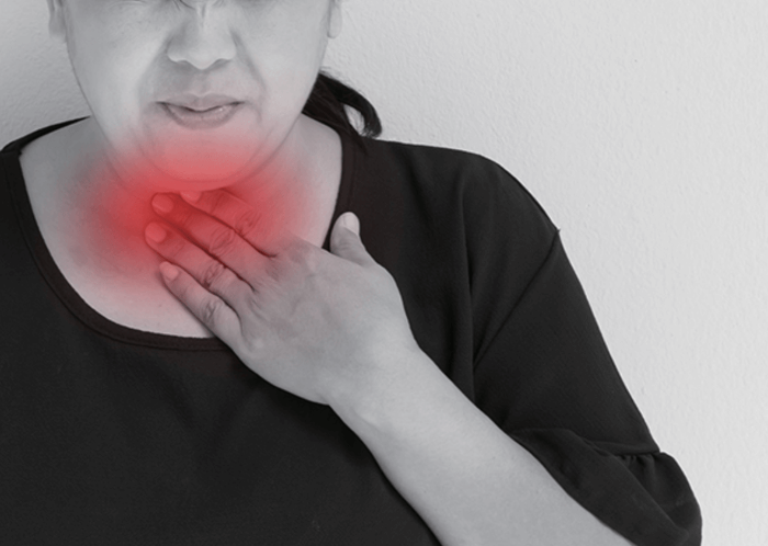 위식도 역류 질환 (GERD)