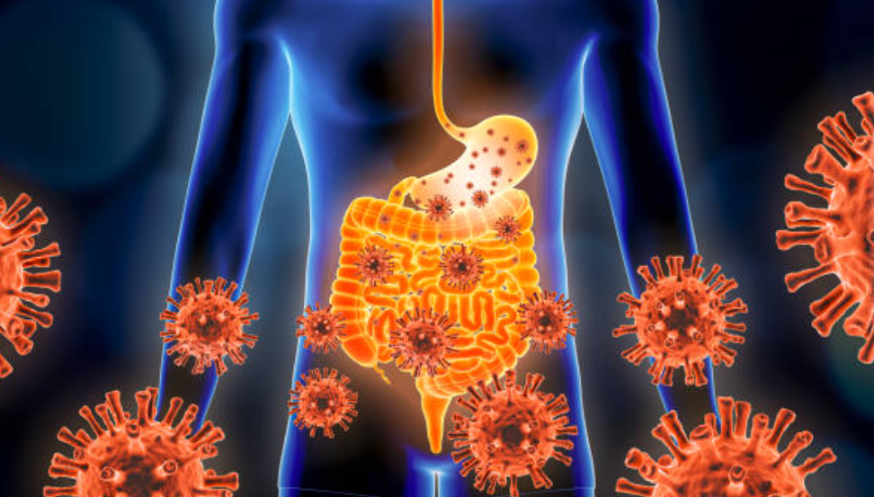장염과 관련된 사진