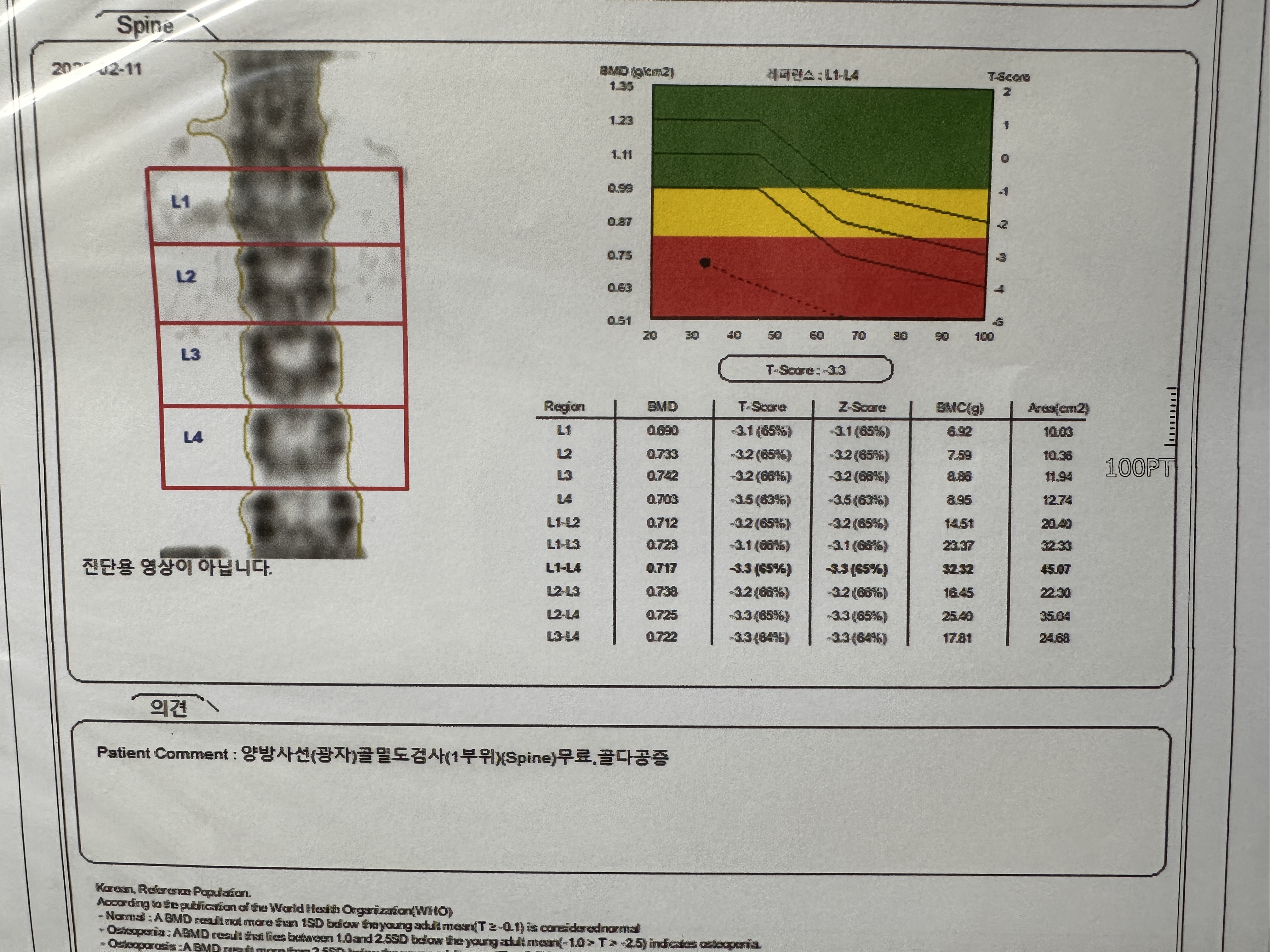 골다공증 병원 검사 과정 상세 후기