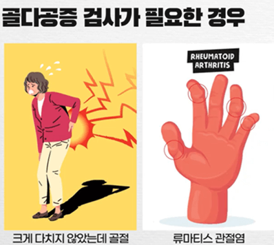 골다공증 검사 비용