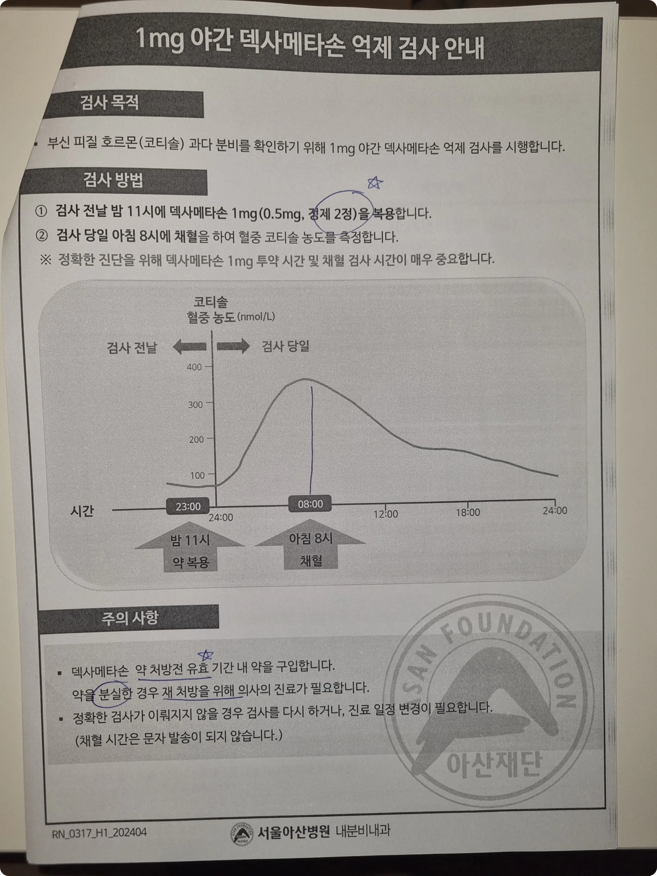 서울 아산병원 덱사메타손 안내
